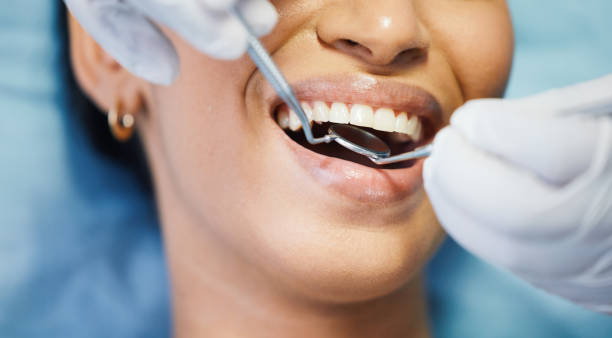 Best Broken or Cracked Tooth Emergency Dentist in Antwerp, OH