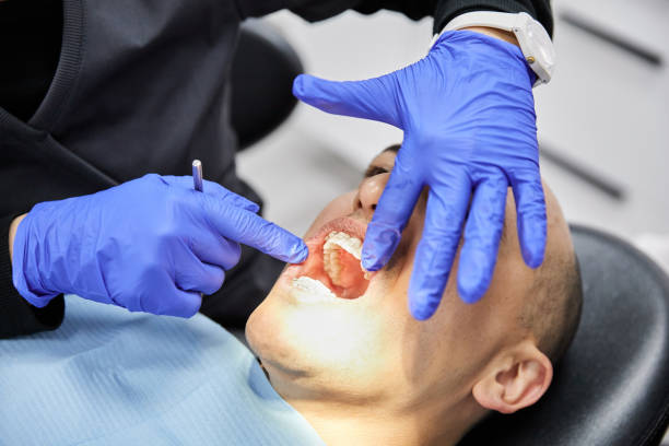 Best Emergency Dentist for Knocked-Out Tooth in Antwerp, OH